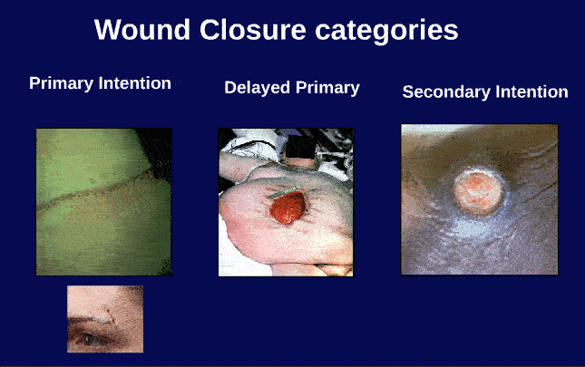 Primary Wound Care
