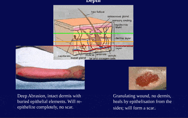 Primary Wound Care