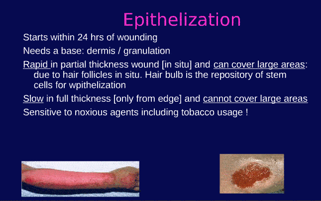 Primary Wound Care