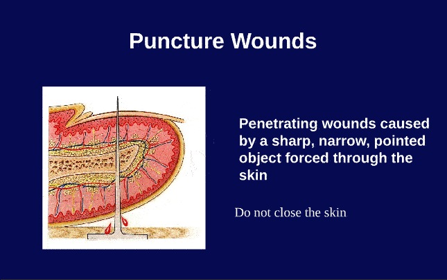 Primary Wound Care