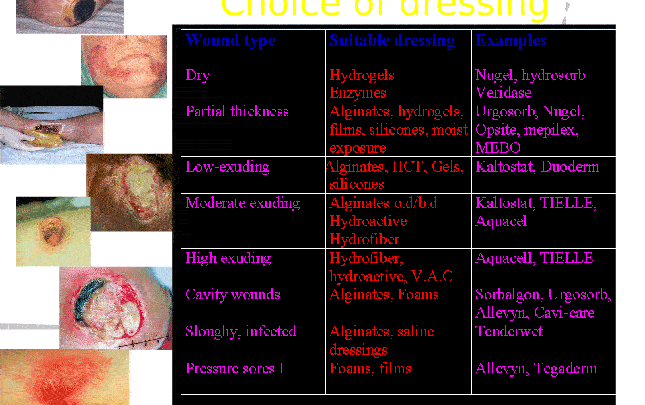 Wound dressing science and art