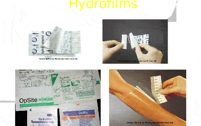 Wound dressing science and art