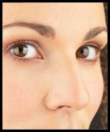 Fat grafting with PRP